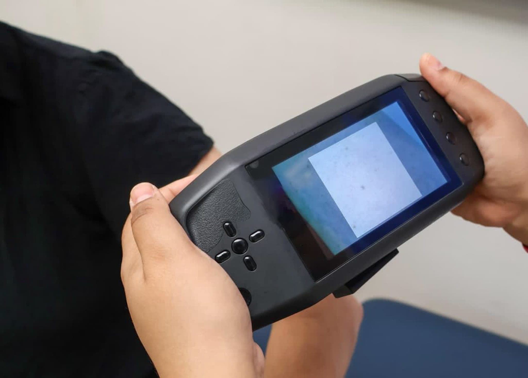 A handheld DeepDerm device held in both hands, its screen showing a live skin capture.